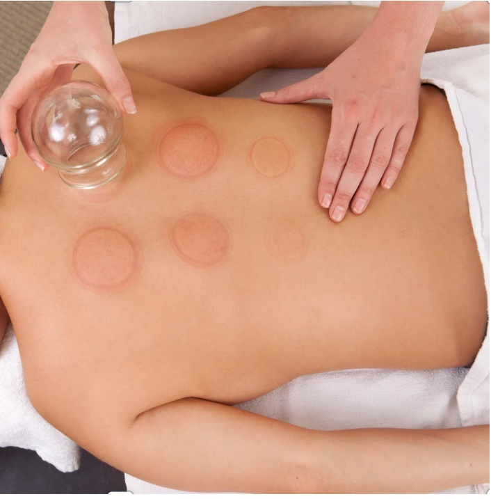 Cupping Therapy for Low Back Pain Colorado Springs | 80920