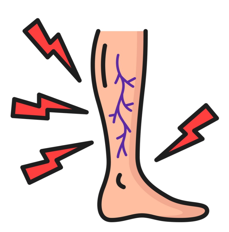 Shooting Pain Down Your Leg? It Might Not Be Sciatica
